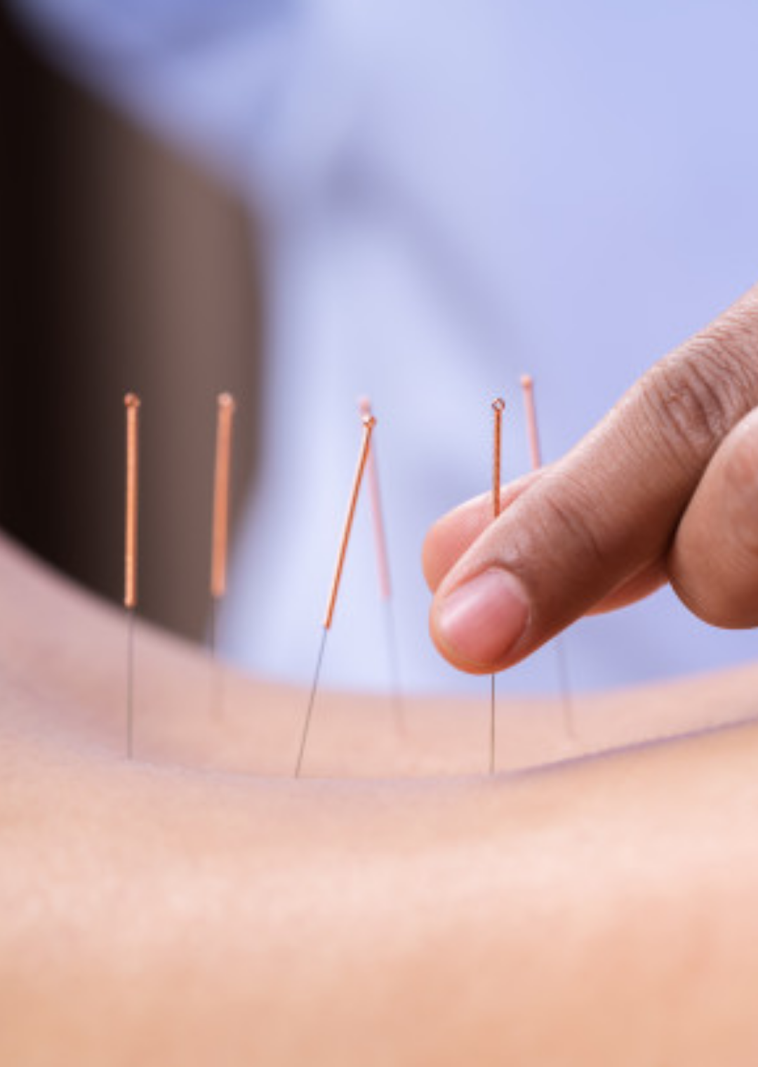 iii-curso-electroneuroacupuntura